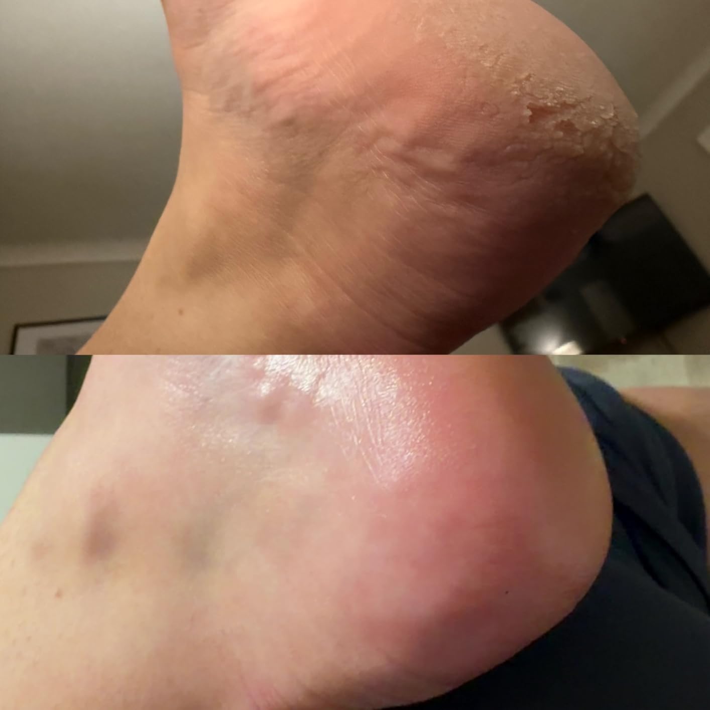 Efekt SilkHeel™ — gładkie pięty po pierwszym użyciu